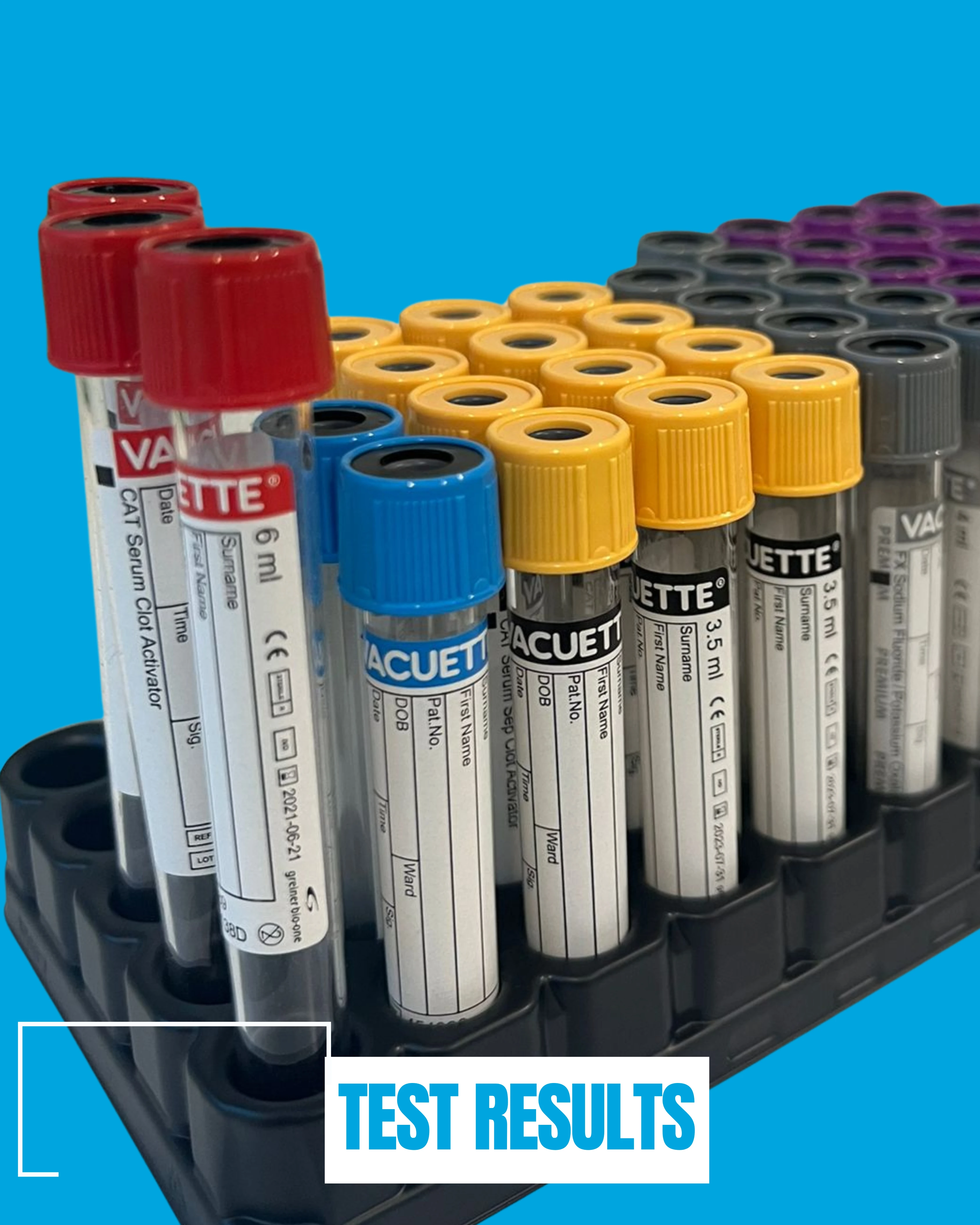 Tests and results for HIYOS GP Practice. A collection of blood test tubes in various colours, arranged on a black holder, with a blue background. The foreground features the words 'TEST RESULTS' in bold white text.