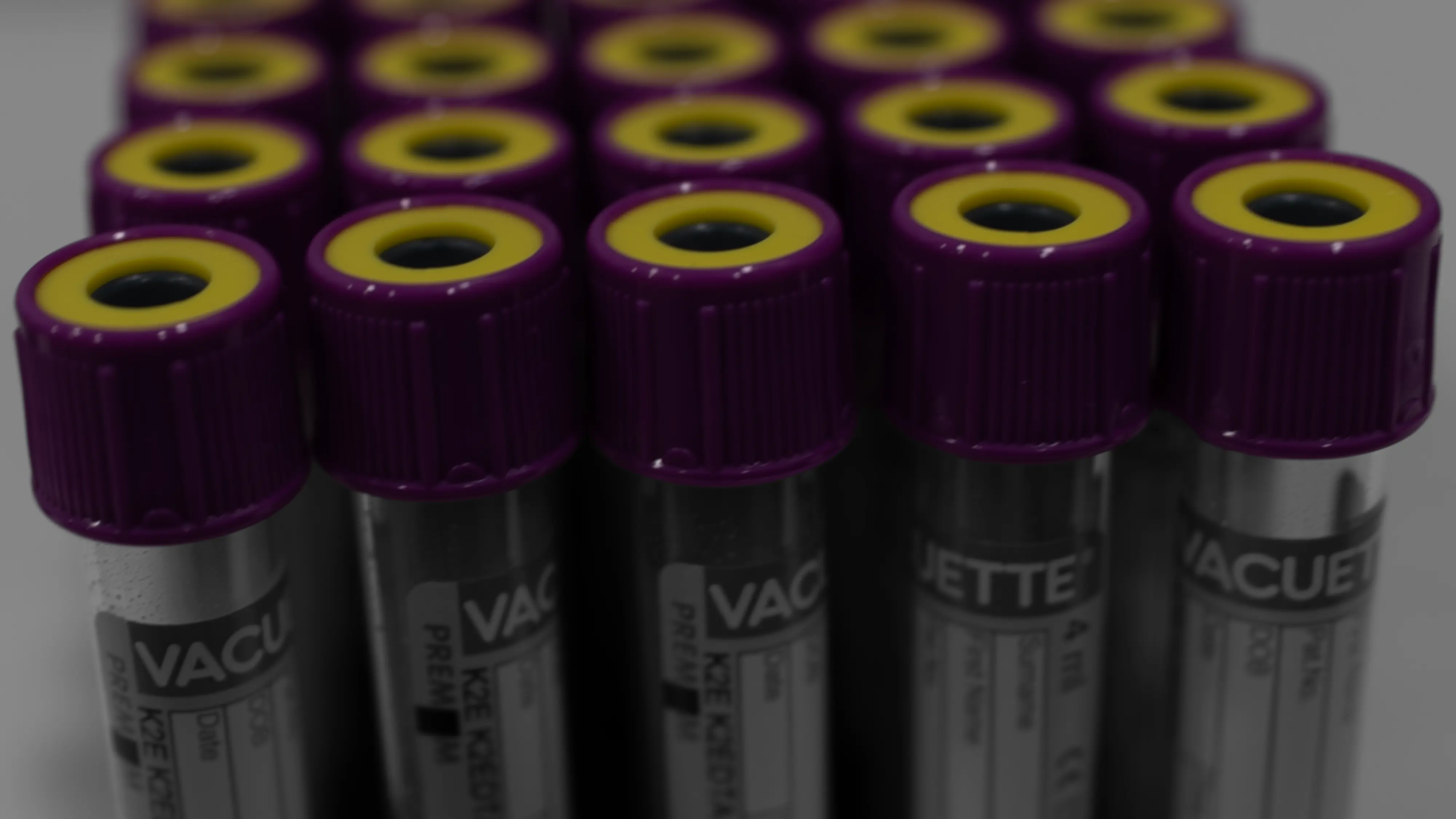 Tests and results for HIYOS GP Practice. Close-up of multiple vacuum blood collection tubes with purple tops and yellow rings, arranged closely together.